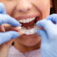 Invisalign or Braces; Which is Better?