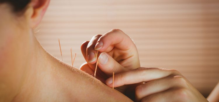 What Health Conditions Can Acupuncture Treat?